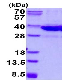 Mouse Recombinant Galectin 8/Gal-8 (from E. coli)