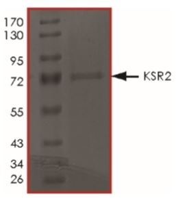 KSR2 نوترکیب انسانی (از باکولویروس (سلول‌های حشره‌ای Sf9))
