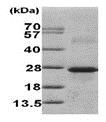 کالنورون ۱ انسانی نوترکیب (از E. coli)