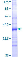 CYP24A1 نوترکیب انسانی (از جوانه گندم)