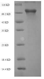 PLBD2 نوترکیب موش صحرایی (از E. coli)
