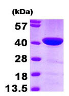 پروتئین تنظیمی اکتین انسانی بازترکیب CAPG/MCP (از E. coli)