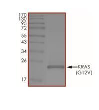 KRAS نوترکیب انسانی (از E. coli)