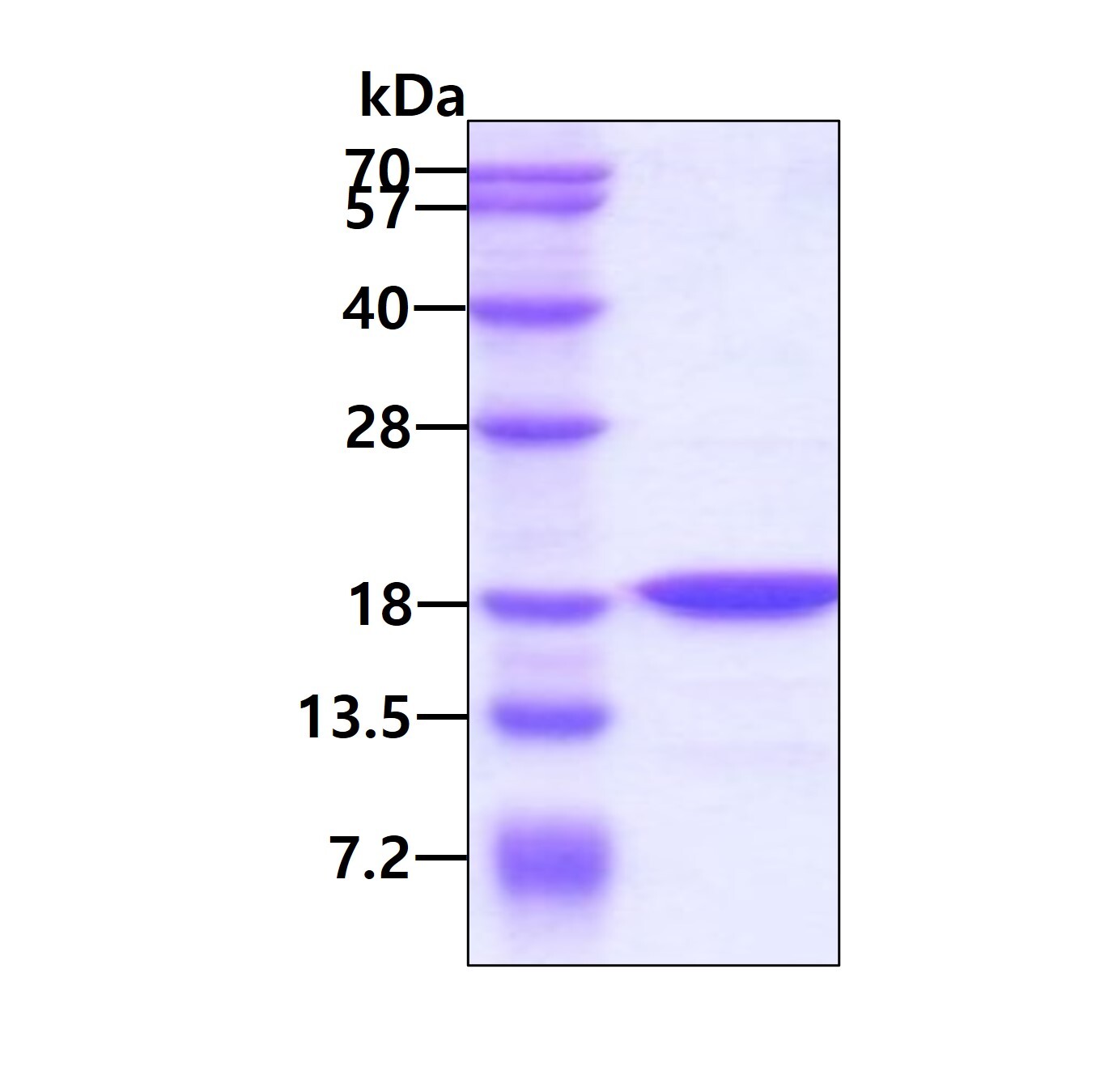 H-FABP نوترکیب انسانی (از E. coli)