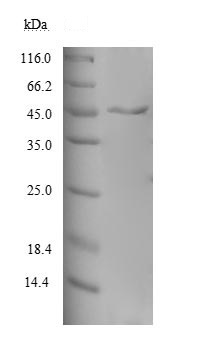مجموعه انسانی MAGEA10 نوترکیب (از E. coli)
