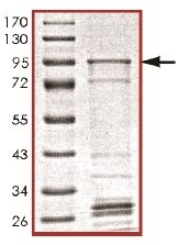 پروتئین نوترکیب انسانی KIAA0652/ATG13 (از E. coli)
