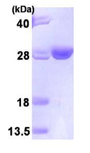 پروتئین نوترکیب انسانی HSPC150/UBE2T (از E. coli)