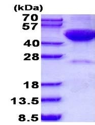 پروتئین بازترکیب انسانی DRAK2 (از E. coli)