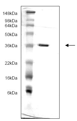 پروتئین انسانی بازترکیب 14-3-3 گاما/YWHAG (از E. coli)