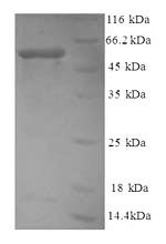 میوزین غیرعضلانی انسانی بازترکیب نوع IIA (از E. coli)
