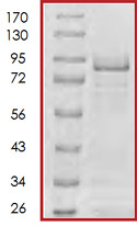 MDM2 نوترکیب انسانی (از E. coli)