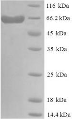 DLL3 نوترکیب انسانی (از E. coli)