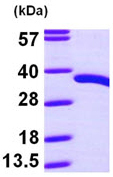 پروتئین نوترکیب PDXP انسانی (از E. coli)