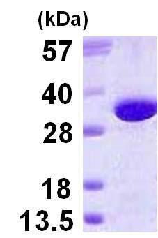 پروتئین انسانی بازترکیب GGH (از E. coli)