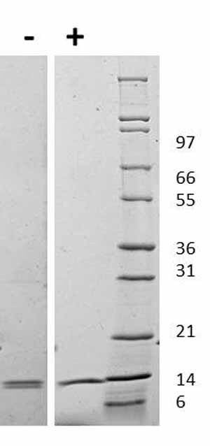 IL-31 نوترکیب موش (از E. coli)