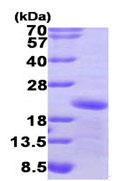 پروتئین بازترکیب انسانی GADD45A (از E. coli)