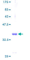 COX6B1 نوترکیب انسانی (از جوانه گندم)