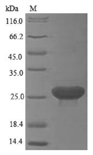 پروتئین انسانی بازترکیب LY6G6D (از E. coli)
