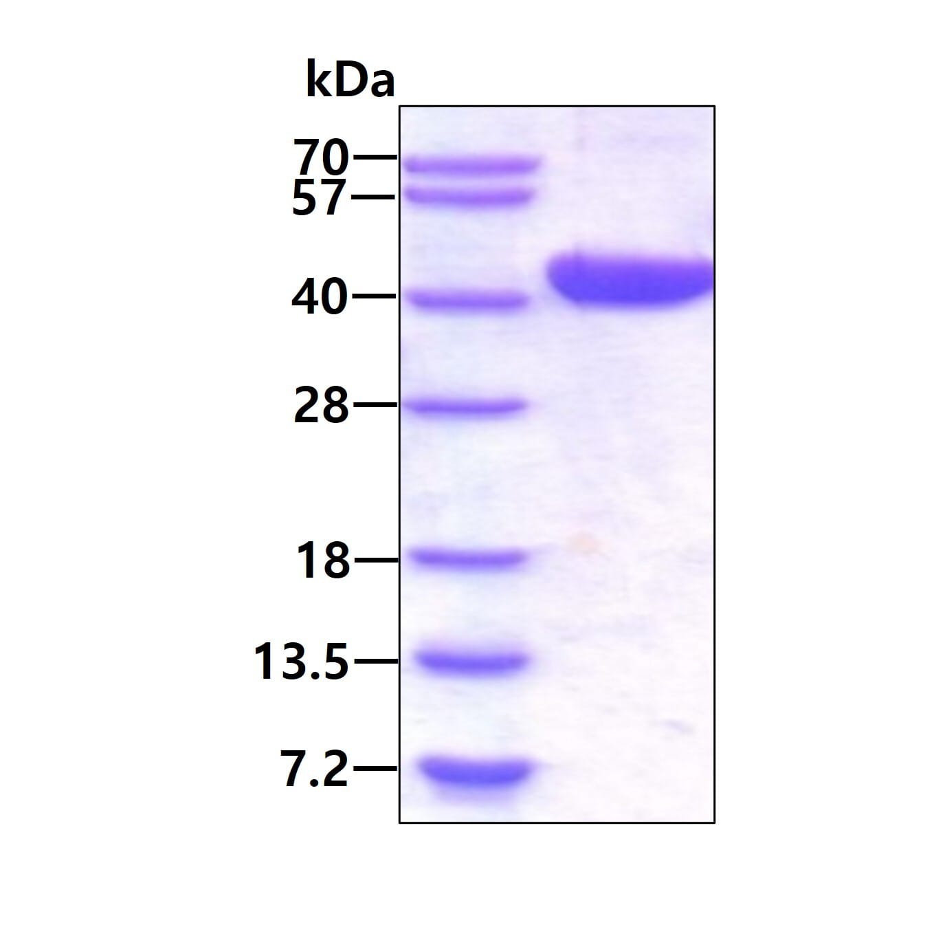 پروتئین انسانی بازترکیب LCMT1 (از E. coli)