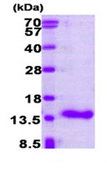 CRABP1 نوترکیب انسانی (از E. coli)