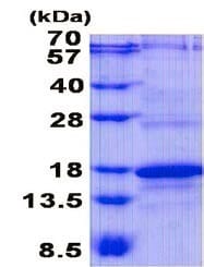 CD3 زتا انسانی بازترکیب (از E. coli)