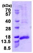 CENPH نوترکیب انسانی (از E. coli)