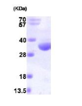 RQCD1 انسانی نوترکیب (از E. coli)