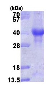 پروتئین انسانی بازترکیب PINK1 (از E. coli)