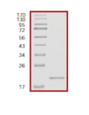 RHEB نوترکیب انسانی (از باکولویروس (سلول‌های حشره‌ای Sf9))