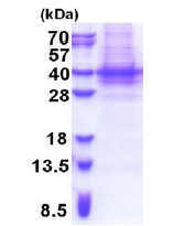 پروتئین انسانی بازترکیب PIH1D1 (از E. coli)