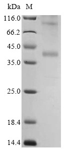 CCR4 نوترکیب انسانی (از E. coli)