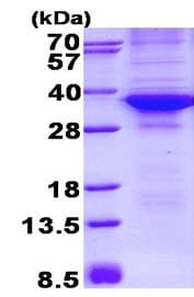 Cdk4 نوترکیب انسانی (از E. coli)