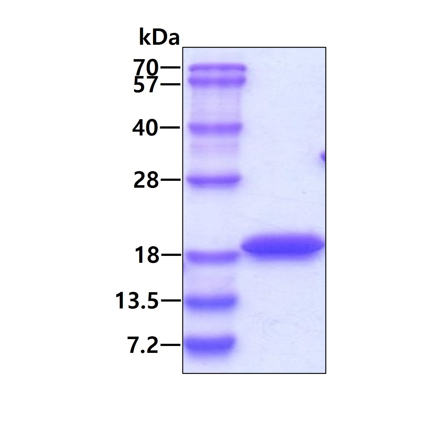 سیتوکروم b5 نوترکیب انسانی (از E. coli)