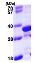 TPM4 نوترکیب انسانی (از E. coli)