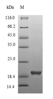 اچ‌ام‌جی‌سی‌آر نوترکیب موش (از E. coli)