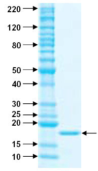 TRAIL نوترکیب انسانی (از E. coli)