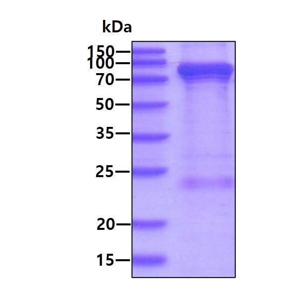 PFKM نوترکیب انسانی (از E. coli)