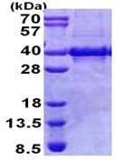 مایوزنین ۱ بازترکیب انسانی (از E. coli)