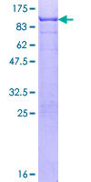 SOX9 نوترکیب انسانی (از جوانه گندم)