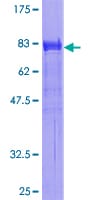 SH2B1/PSM انسانی نوترکیب (از جوانه گندم)