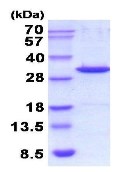 گالکتین ۳ نوترکیب موش (از E. coli)