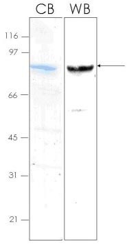 SPARC نوترکیب انسانی (از E. coli)