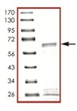 SIRT3 نوترکیب انسانی (از E. coli)