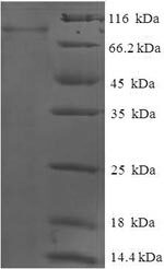 GCKR نوترکیب انسانی (از E. coli)